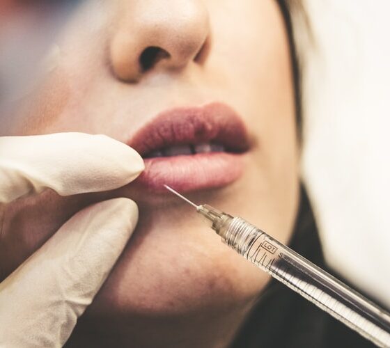 POST CARE FOR INJECTED LIPS- EVERYTHING TO AVOID