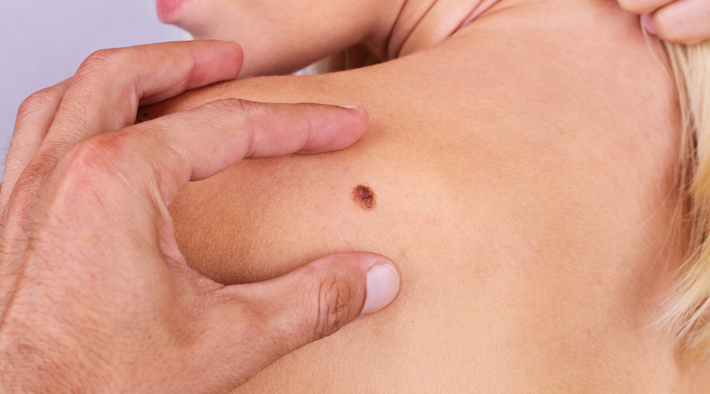 What Makes Sydney Skin Cancer Clinics Professional?